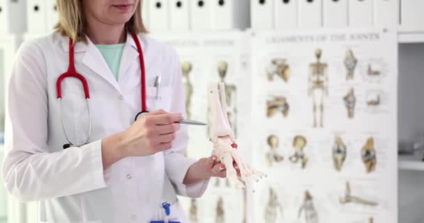 Врач Ортопед Держит Клинике Скелет Человеческой Ноги Остеопороз Хронически Прогрессирующее — стоковое видео