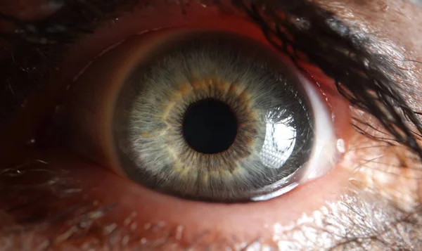 Macro view of open gray eye, small pupil. Treatment of eye diseases, vision problems, frightened look