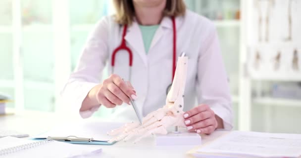 Doctor Explains Operation Foot Bone Model Pain Joints Legs — Video Stock