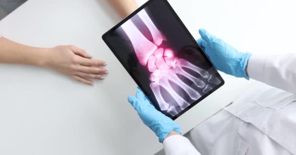 Entzündung Der Handknochen Auf Dem Röntgenbild Des Patienten Konzept Handstauchungen — Stockvideo