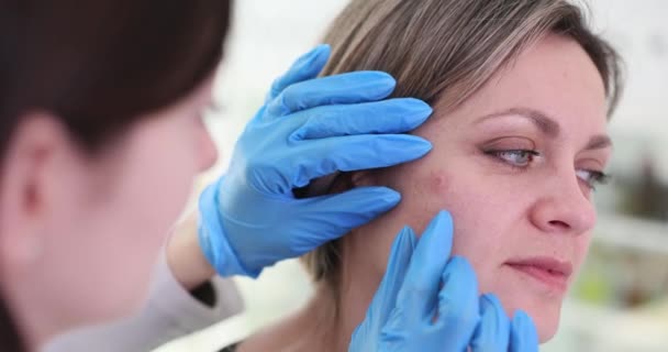 Dermatologe Doktor Untersucht Erodiertes Neoplasma Auf Der Gesichtshaut Von Patientinnen — Stockvideo