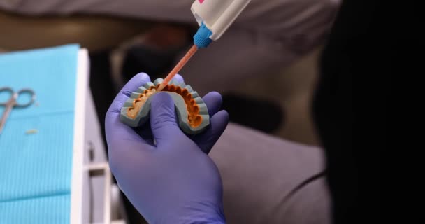 Tandläkare Förbereder Material För Tandavtryck Tandläkare Förbereder Sig För Att — Stockvideo