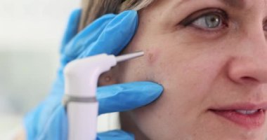 Dermatolog, cilt bakımı üzerinde dermatoskop kapanış filmi ağır çekimde neoplazmayı inceliyor. Deri hastalıklarının tedavisi ve teşhisi ve onkoloji kavramı