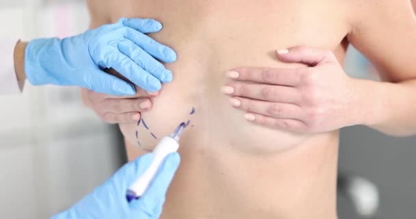 Doctor Makes Dotted Line Womann Chest Lift Breast Augmentation Concept — Stock video