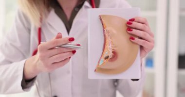 Doktor jinekolog kadın göğsünün hastalıklı anatomik modelini gösteriyor. 4K yavaş çekim. Göğüs kanseri kavramının önlenmesi ve tedavisi