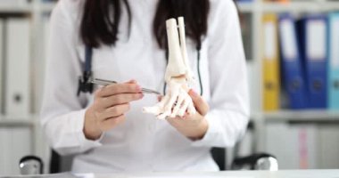 Doktor insan bacak kemiklerinin modelini tutuyor. Kas iskeleti sistem konsepti hastalıkları