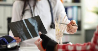 Doktor ve hasta el yaralanması olan bir röntgen çekiyorlar. Yaralanma konsepti için ilk yardım