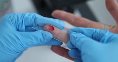 Eldivenli hemşire hasta parmağından kan alıyor. Laboratuvarda cam kaydırak kullanarak 4K film yavaş çekimde. Kan sayımı laboratuvar kontrollerini tamamla.