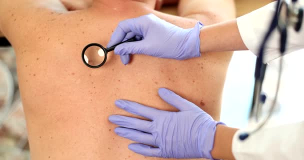 Dermatolog Undersöker Huden Patienten Tillbaka Närbild Dermoskopi Födelsemärken Och Hudcancer — Stockvideo