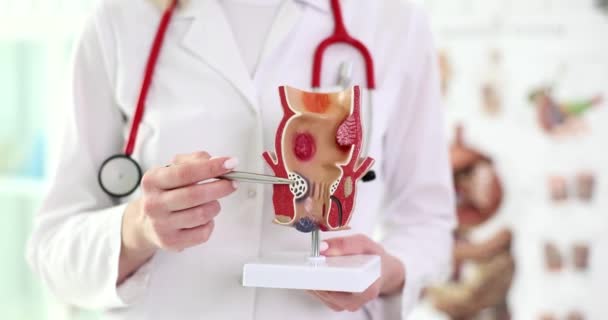 Doktor Rektumun Anatomik Modelini Tutuyor Yakın Plan Proktolog Muayenesi Hemoroit — Stok video
