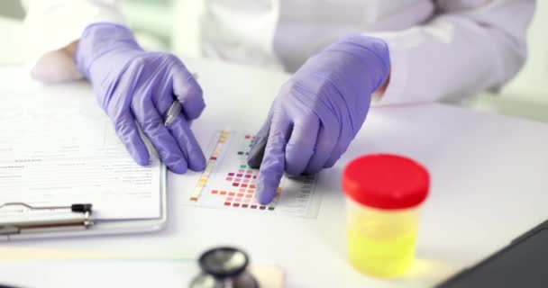 Hands Laboratory Assistant Litmus Test Close Laboratory Testing Urine Diagnosis — Stock Video