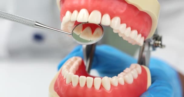 Zahnspiegel Und Anatomisches Modell Des Kiefers Nahaufnahme Wiederherstellung Und Prothetik — Stockvideo