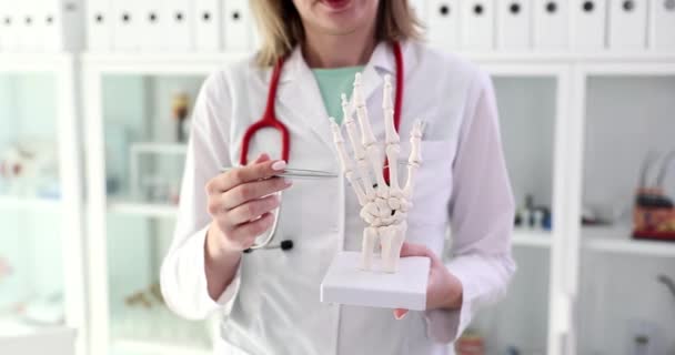 Doktorn Har Anatomisk Modell Handen Närbild Samråd Med Ortoped Slowmotion — Stockvideo
