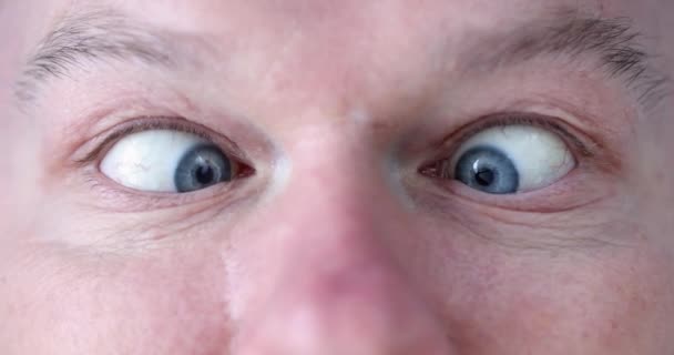 Młody Człowiek Niebieskimi Oczami Zezulcem Korekta Koncepcji Zez Dorosłych — Wideo stockowe