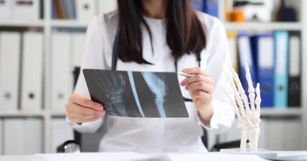 Arzt Traumatologe Blick Auf Röntgenbild Der Hand Auf Dem Hintergrund — Stockvideo