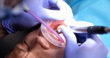 Kadın dişçi, dişçi kliniğinde genç bir kızın dişlerini tedavi ediyor. Diş aletleri kabartmalı doktor.