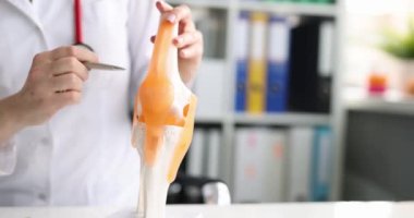 Doktor, tıbbi ofiste yapay diz ekleminin modelini gösteriyor. Diz eklemleri ve bağları hastalıkları