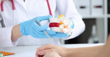 Doktor, sırt yapay disk fıtık modelinin iltihaplanmasına işaret ediyor. Omurgalar arası fıtık tedavisi