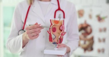 Kadın doktor kalem ve rektum modelini iltihaplı tutuyor. İş üniforması uzmanı öğrencilere rektal kanal hastalıklarını açıklıyor