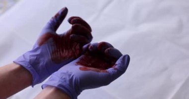 Doktor, kırmızı kan çekiminde lastik koruyucu eldivenleri teslim etti. İç kanama ve tıbbi yardım