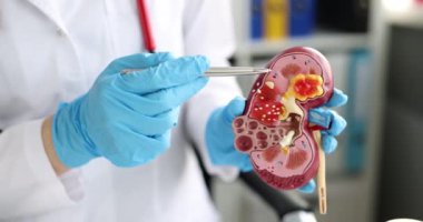 Doktor Nefrolog yapay model üzerinde böbrek hastalığı gösteriyor. 4K film yavaş çekim. İdrar sistemi konsepti hastalıklarının teşhisi
