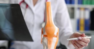 Travmatolog röntgeni inceliyor ve dizine yakın 4K filminin anatomik modelinde sorun gösteriyor. Romatoid eklem iltihabı teşhisi ve tedavisi