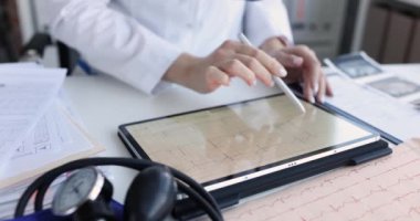 Kardiyolog kardiyoloji kliniğindeki tablette elektrokardiyogramı inceliyor. İskemik kalp hastalığı semptomları ve tedavi konsepti