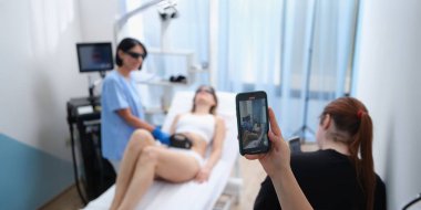 Smm yöneticisi sosyal medya reklamları için cep telefonunda lazer tüyü temizleme videosu çekiyor. Lazer tüy temizleme eğitim konsepti