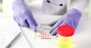 Laboratuvar çalışanı, idrar tahlilinden sonra test göstergesi kağıdıyla renkleri eşleştirdi. Kadın sarı sıvı ağır çekimde konteynırın yanında araştırma yapıyor.