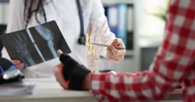 Kadın doktor kırık elle röntgen okur. Bilek ağrısı teşhis ve tedavi kavramına neden olur.