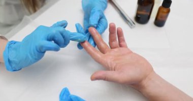 Deri uzmanı klinikteki hasta parmaklarına yatıştırıcı yağ uyguluyor. Doktor cilt durumunu iyileştirmek ve canlandırmak için özel ilaçlar kullanıyor.