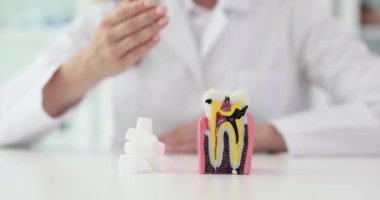 Diş hekimi, masadaki diş modelini ve şeker küplerini gösteriyor. Kadın doktor, hastaya şeker alımı ve çürükler arasındaki bağlantıyı vurguladı