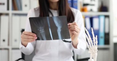 Profesyonel doktor klinikte el kemiklerinin röntgenini çekiyor. Modern tıp ve kalifiye sağlık kavramı.
