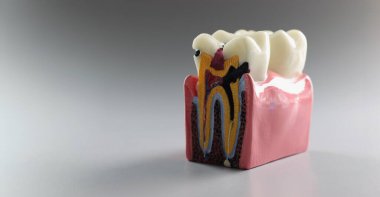 Gri arka planda kesişen bir dişin yakın plan modelini öğretiyorum. Diş hekimliği için kaynak öğreniyorum. Diş dolguları