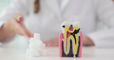 Diş hekimi, dişçilikte diş modelini kullanarak şekerin etkisini açıklıyor. Sıhhiye, tatlı ürünlerin zararlı etkilerine açık bir açıklama getiriyor