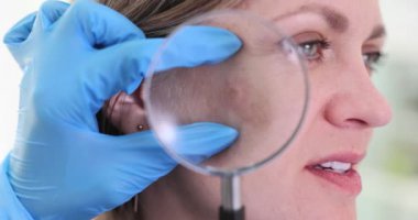 Dermatolog, hastanın yanağındaki sivilceyi büyüteçle inceliyor. Doktor uygun tedaviyi doğru bir şekilde tanımlamak ve planlamak için ayrıntıları inceler.