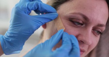 Cildiyeci kadın yüzündeki büyük sivilceleri yakından inceliyor. Doktor hasarlı yanak derisini alçıyla kapatmak için boyutu ve görünüşü inceliyor.