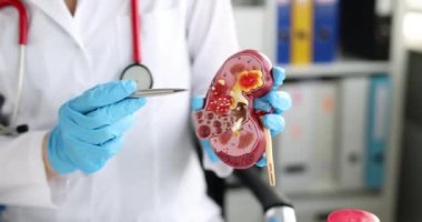 Doctor urologist and nephrologist holds kidney model. Urological diseases and pain in the kidney area concept