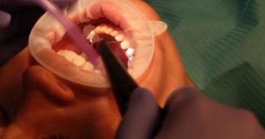 Dentist cleans dirt from patient teeth with water spray in clinic. Doctor does medical procedures in customer oral cavity at appointment in hospital
