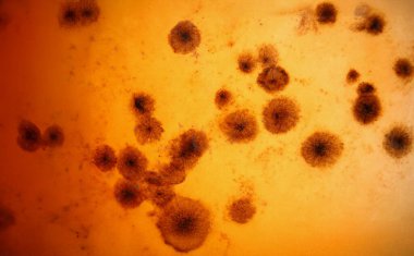 Mikroskop altında mikropların yakın çekimleri profesyonel laboratuvar ekipmanları altında incelendi. Makro aspergillus mikrobu iğnesi. Laboratuvar, bilim konsepti.