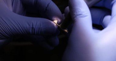 Eldivenli dişçi, dişçi kaplamasını profesyonel ekipmanlarla cilalıyor. Sıhhiye ağır çekimde kullanılacak malzemeyi dikkatlice hazırlar