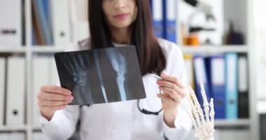 Kadın doktor ellerin röntgen fotoğrafını inceliyor. - Evet. Yaralanma sonrası iskelet kemikleri incelenirken tıbbi bakım