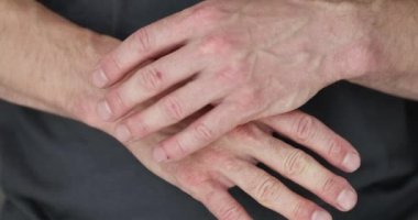 Adam ağır çekimde eklem ağrılarından muzdarip ele dokunuyor. Genç adam kollarında nadir görülen bir hastalığın yol açtığı acı belirtileri yaşıyor.