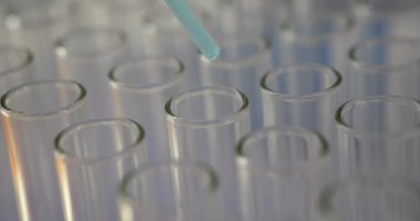Yetkili laboratuvar teknisyeni test tüplerine reaktör ekliyor. Laboratuvar asistanı deney için gerekli olan ayıraç miktarını eklemek için pipette kullanır