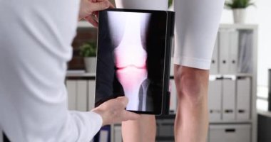 Doktor dikkatli bir şekilde modern cihazla hastanın eklem röntgenini çeker. Ortopedist, hastanın dizindeki kemiklerin durumunu tablet kullanarak inceliyor.