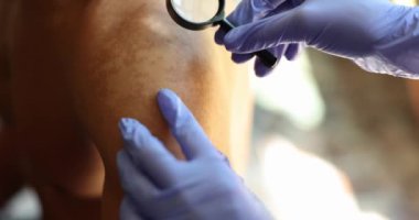 Dermatolog hastanın cildini büyüteçle dikkatlice inceliyor. Hastanede deri hastalıklarının önlenmesi ve tedavisi