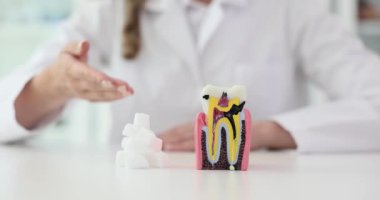 Kadın dişçi şekerin diş sağlığı üzerindeki etkisini gösteriyor. Doktor diş çürüme sürecini açıklamak için diş ve şeker kalıbı kullanıyor.