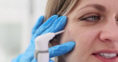 Steril eldivenli doktor, kadın hastanın yüz benini çıkarmak için radyasyon cihazı kullanıyor. Dermatolog zararlı cilt kusurunu ortadan kaldırdı