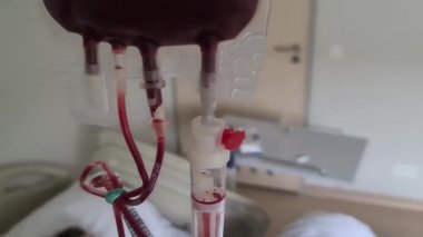 Kan nakli sırasında tüpten kan damlıyordu. Hasta hastane yatağında yatıyor ve tedavi sırasında serum takılıyor.