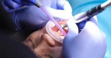 Steril eldivenli dişçi diş temizliği yapar. Doktor hasta dişlerindeki plağı söker ve ağzındaki tükürüğü çıkartır. Diş çürükleri ve diş eti hastalıklarını önler.